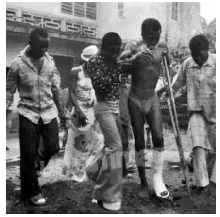Fela in 1975 after being beaten and wounded by soldiers